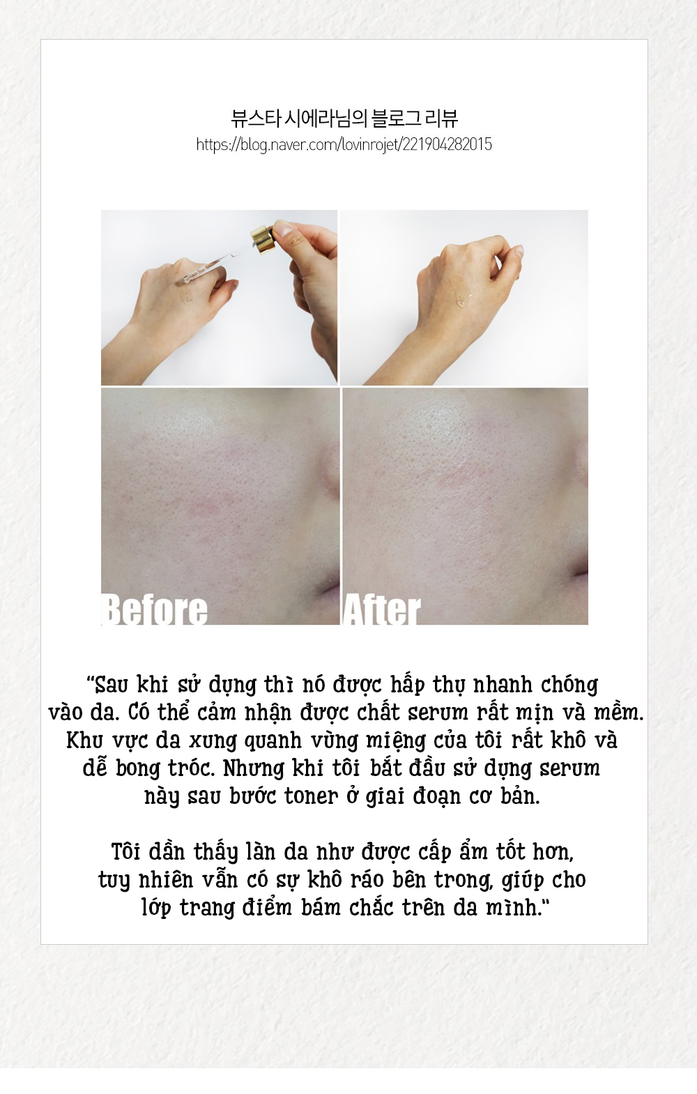 Serum Ngua Nam Tan Nhang Perfection Concentrated Ampoule (3)