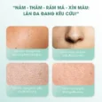 Kem dưỡng ẩm mờ nám cải thiện sắc tố da Care:nel Anti-Melesma Centella Cream 40ml