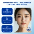 Toner phục hồi da, ngừa nám sạm, cải thiện hàng rào da Care:nel Cica Vita B5 Tranexamic Acid 155ml