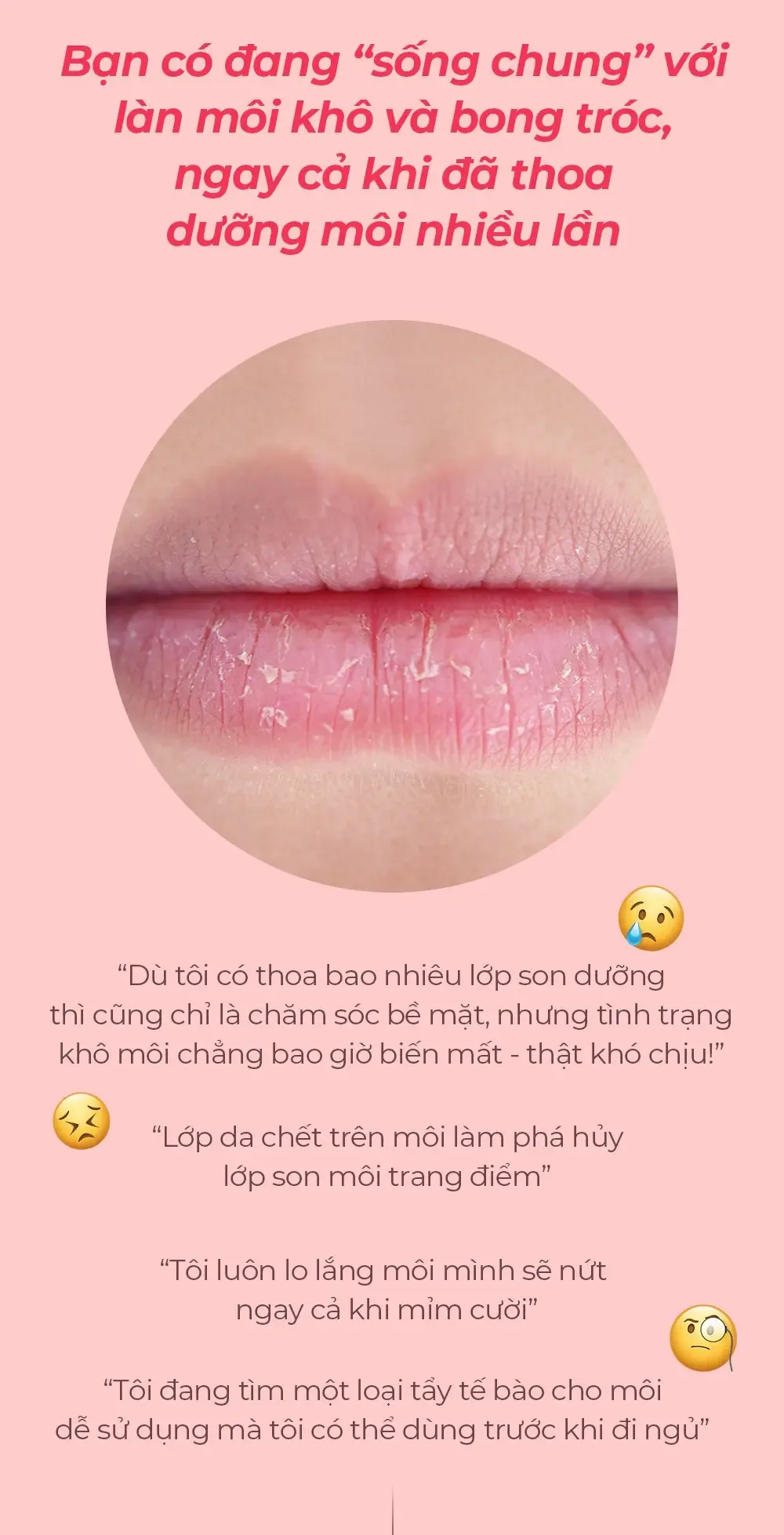 Cận cảnh đôi môi khô bong tróc với da chết và nhiều đường nứt dọc, kèm những lời than phiền về môi khô