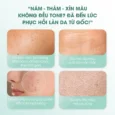Tinh chất ngừa nám sạm Carenel Anti-melasma Cica Intensive Serum 30ml