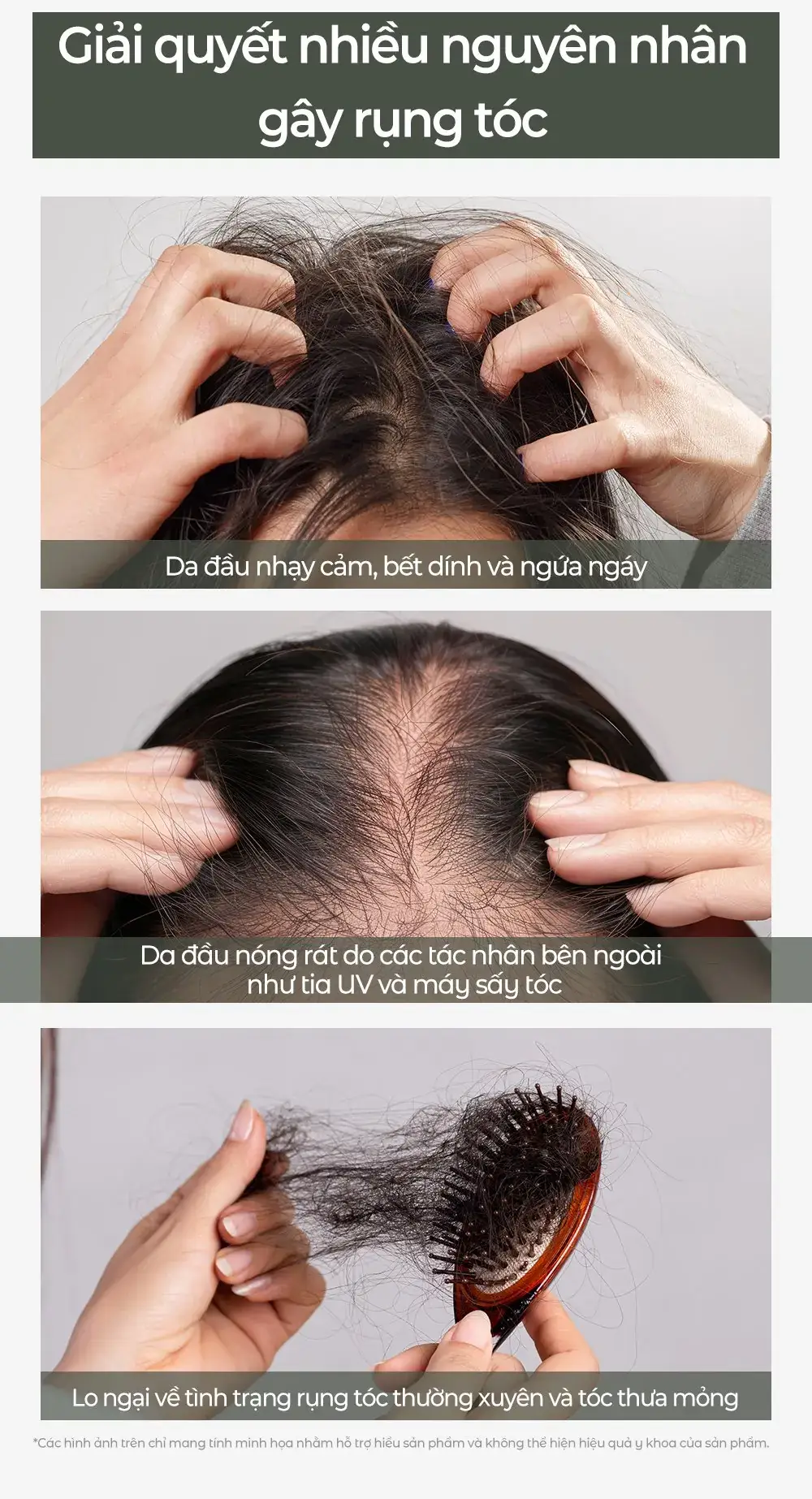 Ba tình huống da đầu và tóc: da đầu ngứa bết dính, da đầu nóng rát do UV, tóc rụng thưa mỏng - cần xịt dưỡng tóc Carenel